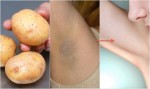 Cắt 1 lát khoai tây rồi chà vào nách trong 5 phút, chị em giật mình khi thấy ngay kết quả