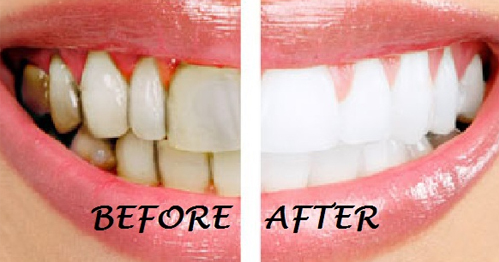 Răng ố vàng đến mấy cũng trở nên ‘trắng sứ’ nhờ ngậm thứ này mỗi sáng