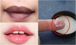 3 bước biến môi thâm bẩm sinh hay do dùng son nhiều chì cũng trở nên hồng hào mà không cần đi xăm