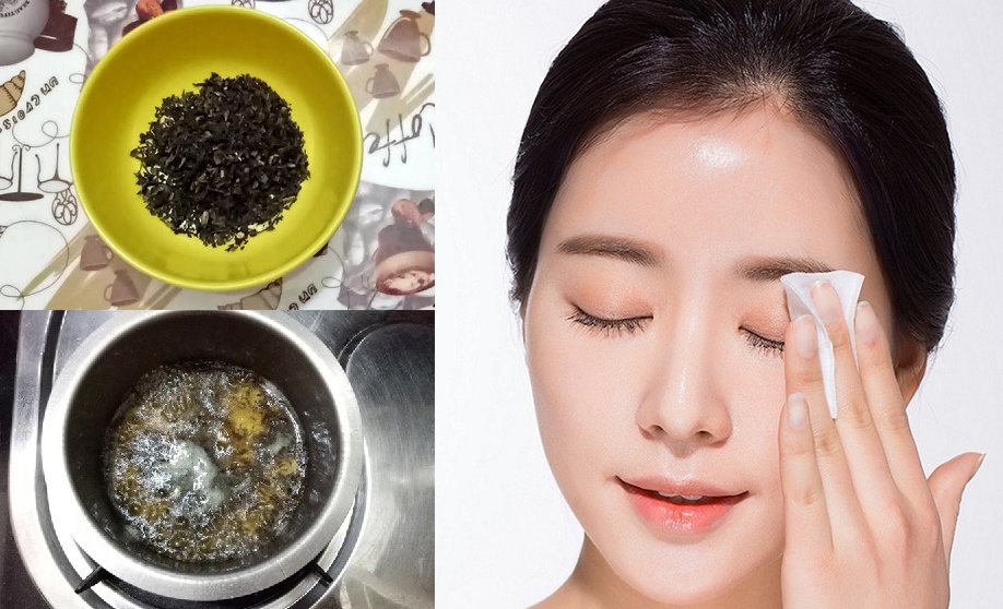 Đun một tí lá trà xanh rồi thoa lên mặt, hiệu quả có được tốt gấp chục lần kem trị mụn đắt tiền