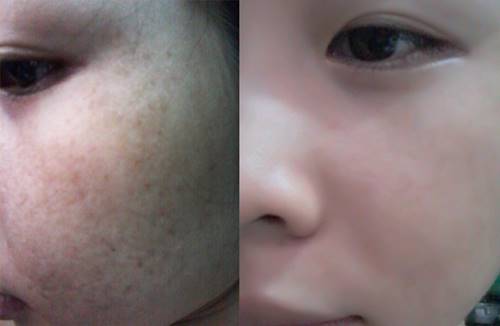 Với 3 phút mỗi ngàyđể sở hữu ngay làn da mịn màng “vạn người mê”