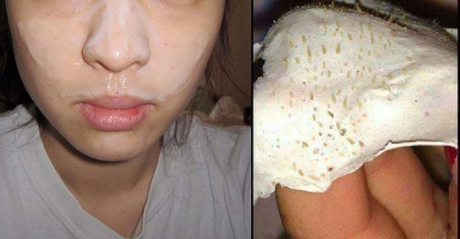 Mụn đầu đen cứng đầu đến mấy cũng phải trồi lên nhờ những thứ này