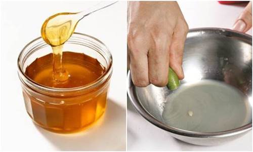 Bí kíp diệt tận gốc mụn đầu đen ở cằm và hai bên cánh mũi sau đúng 1 lần bôi