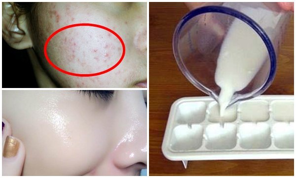 Vô tình nhét cả bịch sữa tươi vào ngăn đá rồi lấy chà lên mặt, chà đến đâu da trắng đến đấy, càng sờ càng thích