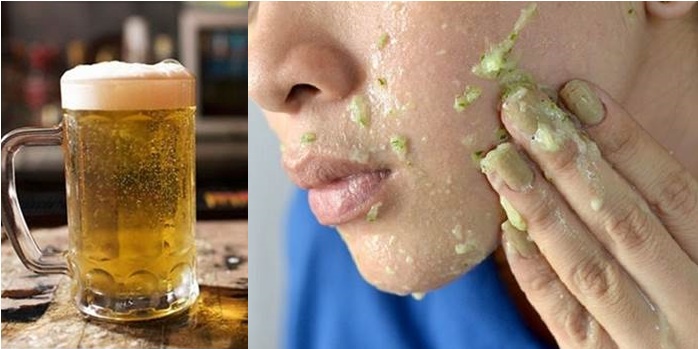 1 lon bia tốt gấp 100 lần spa trị mụn tiền triệu khi sử dụng đúng theo cách này, nếu không biết sẽ tiếc cả đời