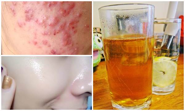 5 loại nước cứ uống buổi tối là da mướt mịn, sạch mụn, mỹ phẩm tiền triệu cũng thua xa