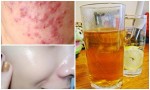 5 loại nước cứ uống buổi tối là da mướt mịn, sạch mụn, mỹ phẩm tiền triệu cũng thua xa