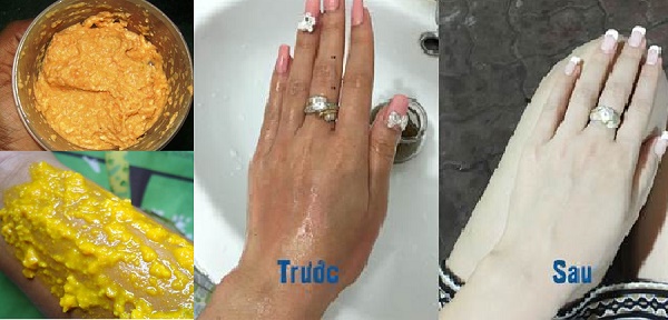 Dùng hết trăm hũ kem trộn cũng không trắng da nhanh bằng 1 lần dùng 1 thìa hỗn hợp này