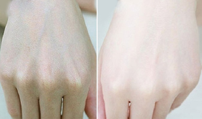 8 tuyệt chiêu để da tay không bị rám nắng suốt ngày hè