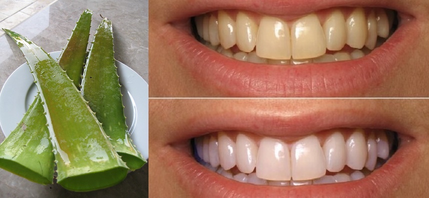 Cắt 1 miếng nha đam rồi chà trong 2 phút, răng trắng bóc như bọc sứ, hết sạch cao răng dù cả năm không đi lấy