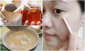 2 thìa nước dừa + 1 thìa mật ong: Tuyệt chiêu 5 phút dưỡng da trắng mịn, xóa mờ mọi vết thâm