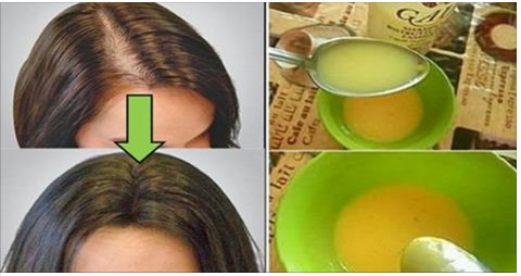 Tóc mỏng, lưa thưa vài cây hay hói trọc lóc cả đầu cũng mọc ra nhanh chóng chỉ cần bôi thứ này và massage từ chân tóc đến ngọn tóc