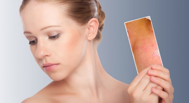 Cách khắc phục lỗ chân lông to trên mặt