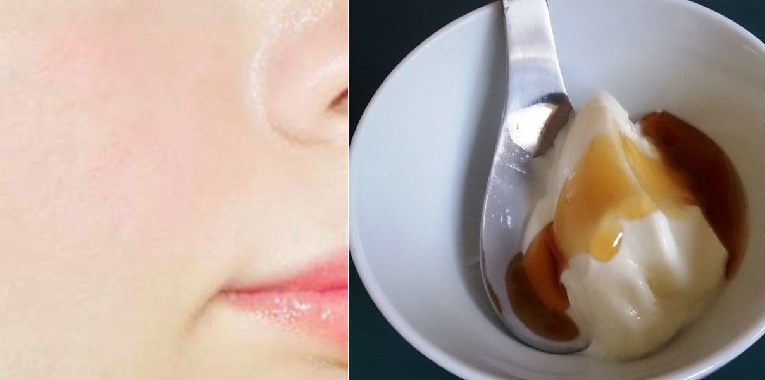 Da trắng như bông tuyết chỉ nhờ thứ đơn giản này thôi