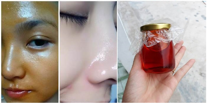 Da ngăm cũng trở nên căng bóng, trắng hồng lại hết sạch vết thâm chỉ sau 7 lần bôi, “đã dùng là thích”