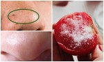 Chấm 1/2 quả cà chua vào thứ này rồi chà lên mũi, mụn đầu đen chi chít cũng bật ra hết sạch sau 1 lần duy nhất