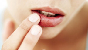 Thoa hỗn hợp này mỗi ngày, môi nứt nẻ, thâm tím cũng hồng hào chỉ sau 1 đêm