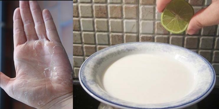 Cứ chạm vào nước rửa bát là bong da tay hãy áp dụng ngay mẹo này để cải thiện nhé