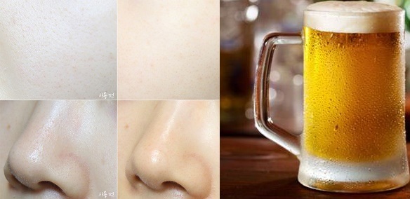 Kinh ngạc se khít lỗ chân lông bằng bia 95‰ chị em thử và đã thành công