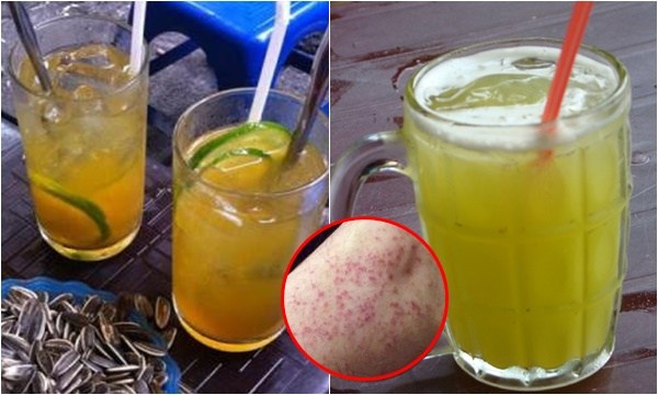 5 loại nước ai cũng uống mỗi khi nắng nóng nhưng tác hại khiến ai cũng sốc
