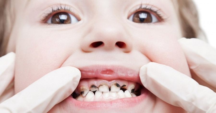 Răng đau buốt, ê nhức đến đâu cũng trị khỏi tức thì nhờ ngậm 1 lát gừng trong 5 phút