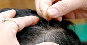 Ai mắc chứng tóc bạc sớm thì đọc bài này, bạn sẽ mừng rơi nước mắt vì tóc đen và suôn mượt trở lại đấy