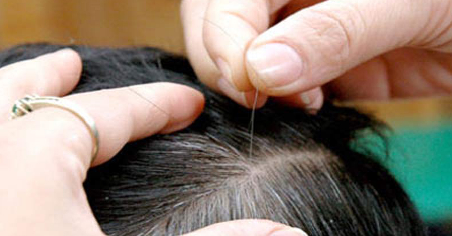 Ai mắc chứng tóc bạc sớm thì đọc bài này, bạn sẽ mừng rơi nước mắt vì tóc đen và suôn mượt trở lại đấy