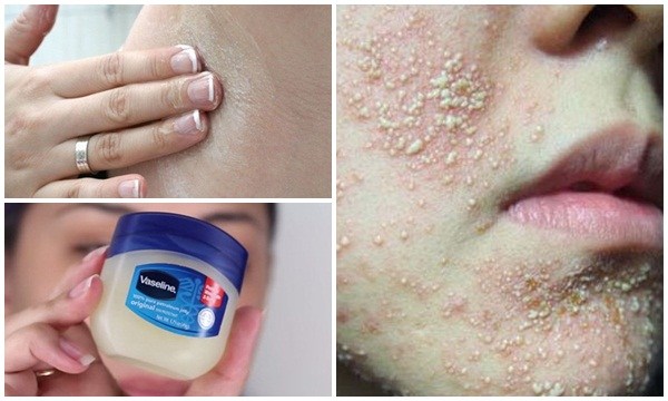 7 thứ bôi lên mặt chẳng khác nào dùng thuốc độc hủy diệt làn da của mình, thế mà hàng ngày chị em vẫn làm