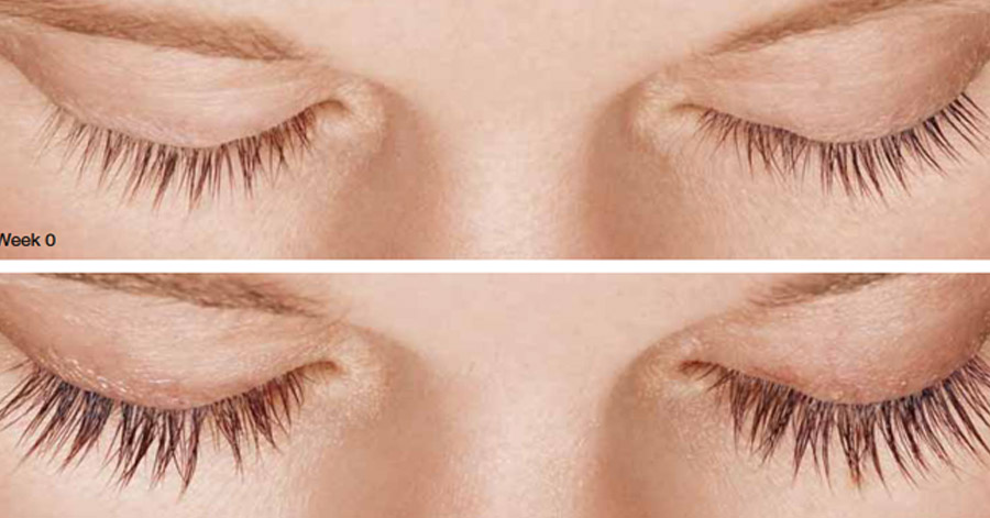 Không cần nối hay gắn mi giả, cứ thoa 1 giọt này mỗi tối, đảm bảo lông mi ngắn ngủn đến đâu cũng dài cong, đậm nét
