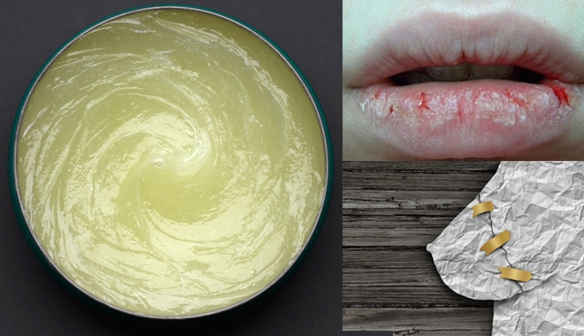 Thoa vaseline hàng ngày, vậy bạn có biết các tác hại của nó?