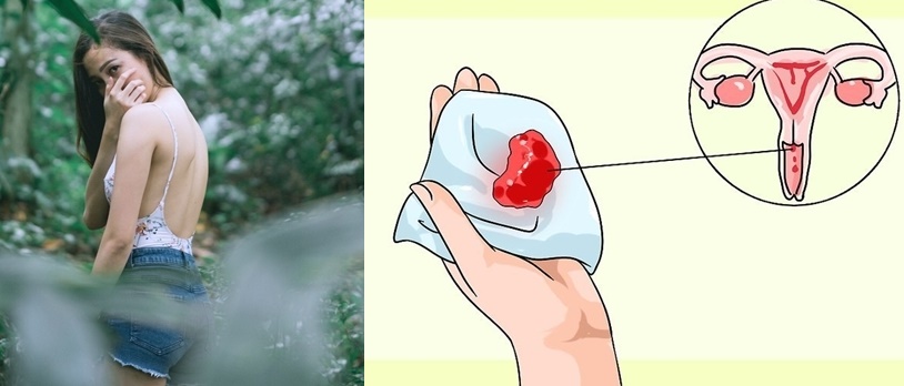 9 vấn đề các cô gái cần biết khi kinh nguyệt kéo dài sang ngày thứ 8