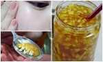 10 ngày làm lọ tỏi ngâm chanh mật ong thế này, da dẻ sạch mụn, láng o lại trắng bóc như em bé ai cũng giật mình
