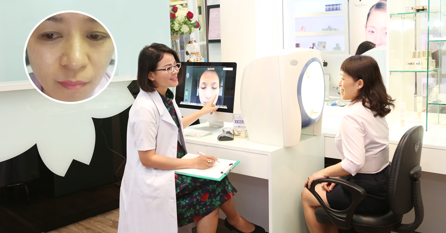 Cô giáo chia sẻ cách trị nám HOT nhất hiện nay, được hàng ngàn chị em cả nước tin dùng