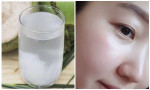 Không cần đến kem dưỡng, cứ uống nước theo cách này thì da sẽ lập tức căng bóng, mịn màng ngay thôi