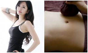 Top 3 mẹo giúp giảm cân không cần nhịn ăn hay tập luyện vất vả