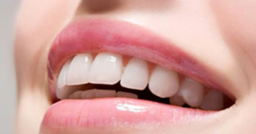 Chuẩn bị 1 thìa sữa chua rồi chà lên răng thế này, chà đến đâu cao răng bong ra đến đó, răng trắng như bọc sứ luôn