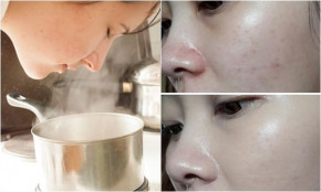 Cách xông hơi giúp bạn sở hữu làn da mịn màng không tì vết