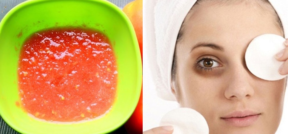 Dùng cà chua theo cách này trước khi đi ngủ, bọng mắt to, thâm đen cỡ nào cũng cải thiện được