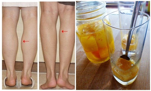 Hô biến chân voi, đùi to như cột đình cũng thon gọn, săn chắc tức thì sau 7 ngày làm theo 3 bước này