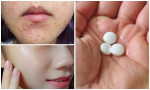 Không thể tin 1 vỉ aspirin rẻ tiền có tới 8 công dụng “thần thánh” giúp chị em làm đẹp hoàn hảo từ đầu tới chân
