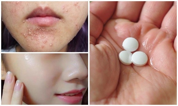 Không thể tin 1 vỉ aspirin rẻ tiền có tới 8 công dụng “thần thánh” giúp chị em làm đẹp hoàn hảo từ đầu tới chân