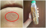 Xóa sổ mụn ẩn, se khít lỗ chân lông nhờ lọ nước thần thánh dễ làm nhưng hiệu quả đến bất ngờ này, tiếc gì không thử chứ!