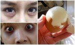 Luộc 1 quả trứng gà rồi lăn vài vòng quanh mắt, 5 phút sau soi gương cô gái hốt hoảng không nhận ra mình