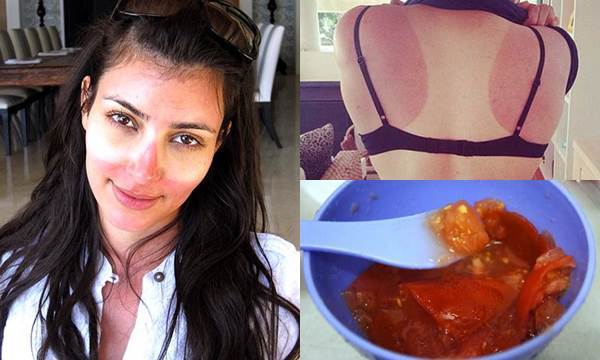 Luộc 3 quả cà chua rồi nghiền nát chà khắp người, da đen loang lổ vì cháy nắng cũng trắng bật tone, thậm chí còn căng mịn hơn trước