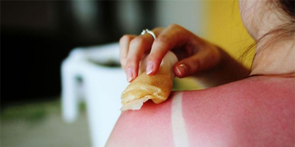 Sau kỳ nghỉ, bí quyết đơn giản để lấy lại thật nhanh làn da trắng do bị cháy nắng