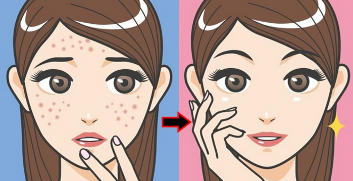 Lột xác như hoa chỉ sau 3 ngày kiêng loại gia vị này