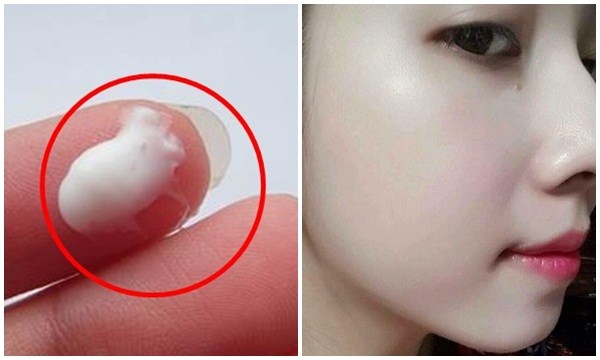 Thoa 3 giọt này mỗi tối, da trắng sứ như Ngọc Trinh, không một vết thâm nám sau đúng 1 đêm duy nhất
