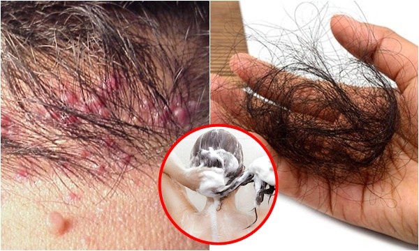 Dù đầu tóc có bẩn đến đâu đi chăng nữa cũng đừng đem đi gội vào thời điểm này nếu không muốn đau đầu kinh niên, chết đột tử