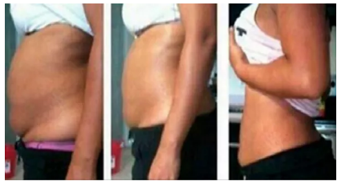 Thật bất ngờ, tôi uống thứ này 2 lần/ngày lại giảm mỡ bụng chỉ trong 15 ngày