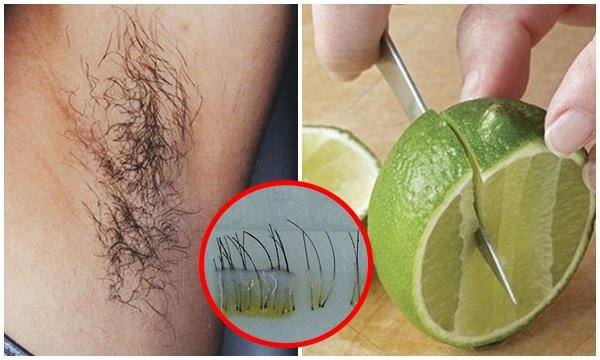 Chẳng cần dùng tới nhíp, lông nách lí nhí sẽ sạch sành sanh không còn 1 cọng nhờ 4 công thức thần kỳ từ 1 quả chanh